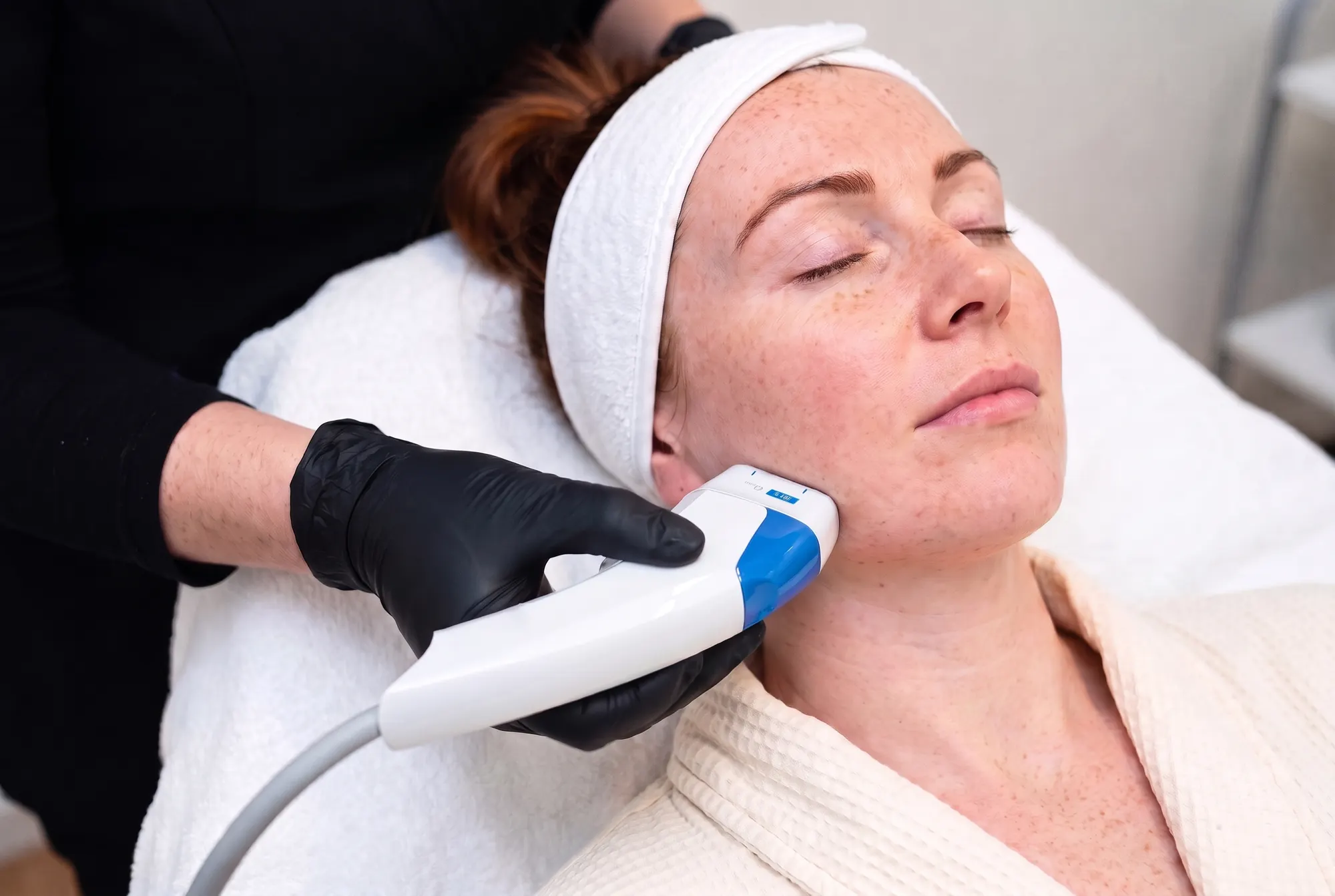 A gloved practitioner holds a curved white Ultraformer MPT handpiece with a blue 4.5 mm cartridge along a client's jawline